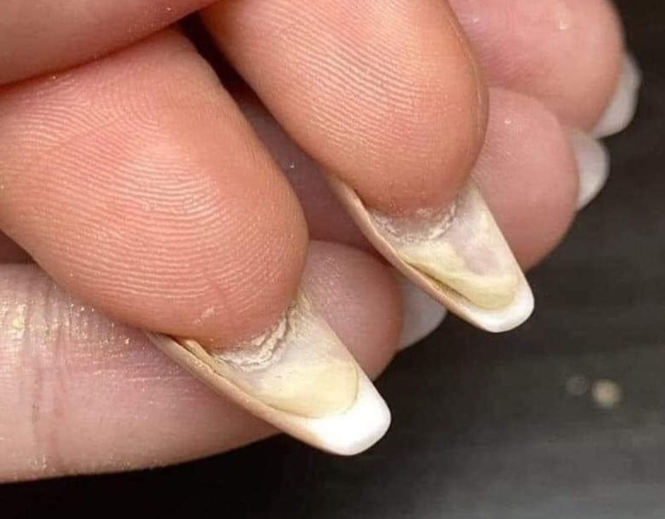 Waarom nagelriemolie onmisbaar is voor mooie en gezonde nagels